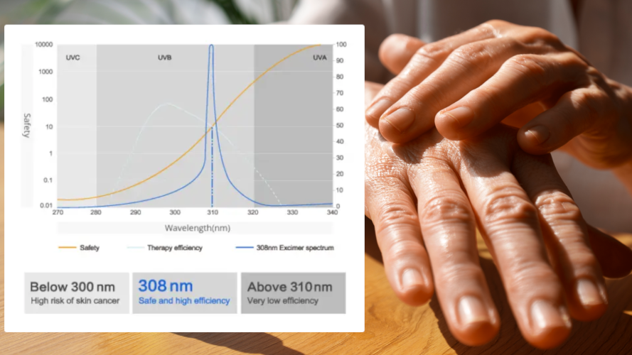 NB-UVB Excimer with Topicals